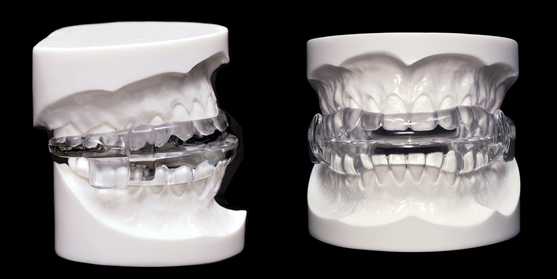 Sleep Apnea Oral Appliance Reviews Testimonials Beachwood Cleveland OH